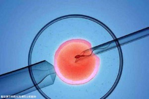 王晨光主任